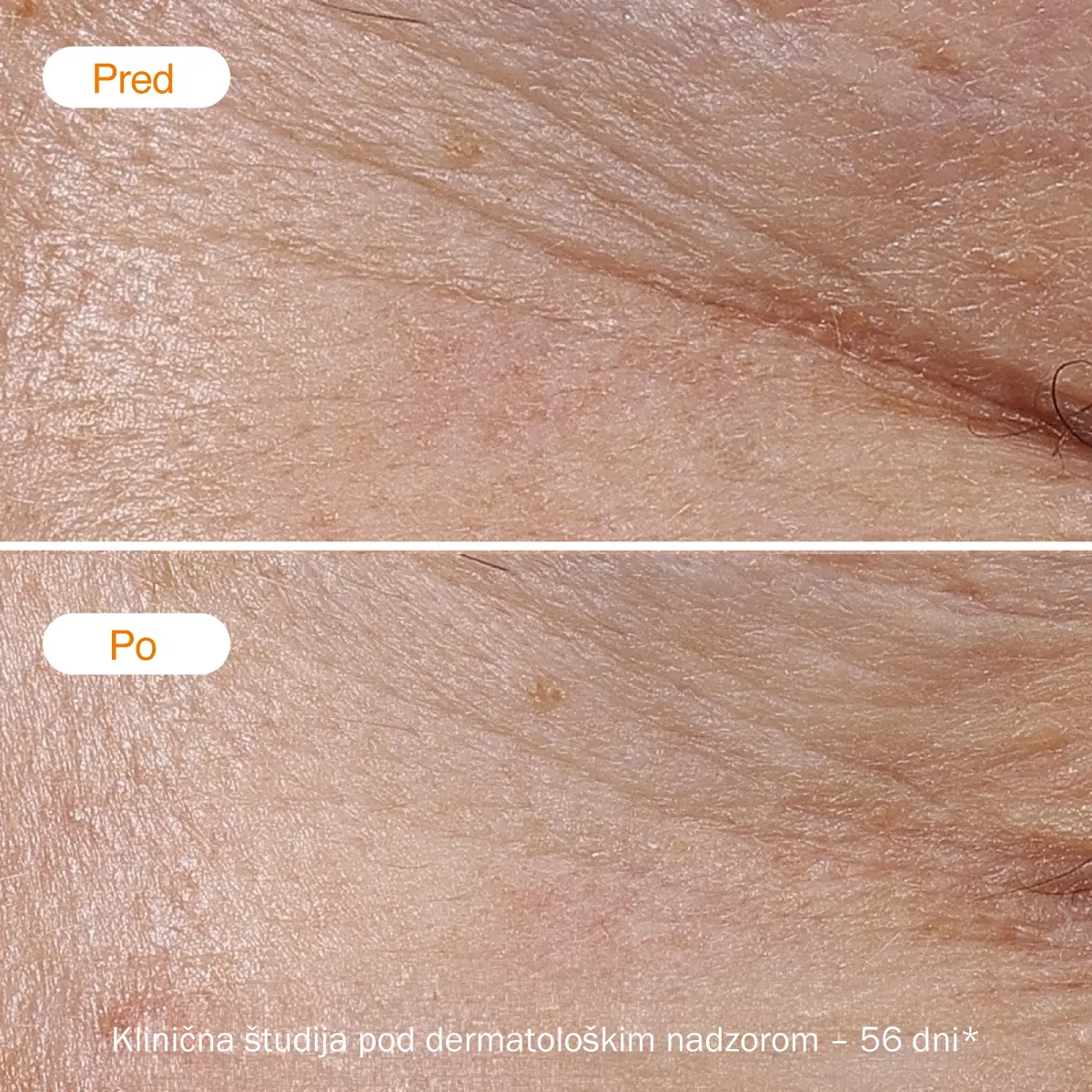 Rezultati pred in po uporabi Novexpert lahke kreme z vitaminom C po 56 dneh